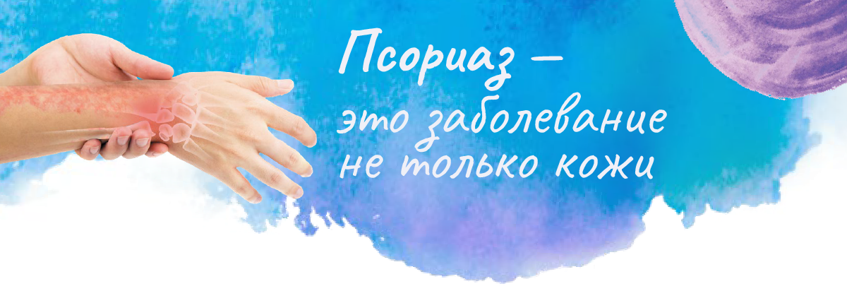 Псориаз - это заболевание не только кожи Псориаз - это заболевание не только кожи
