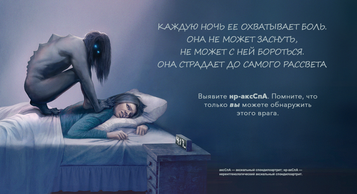 Факты об аксСпА Факты об аксСпА