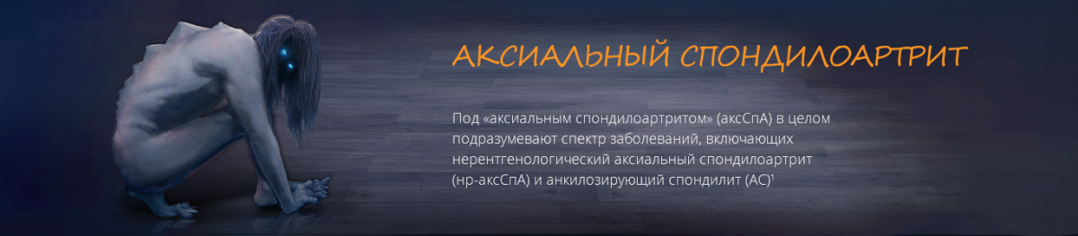 Аксиальный спондилоартрит Аксиальный спондилоартрит