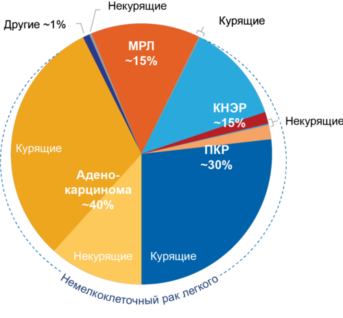 Гистологические варианты рака легкого Гистологические варианты рака легкого