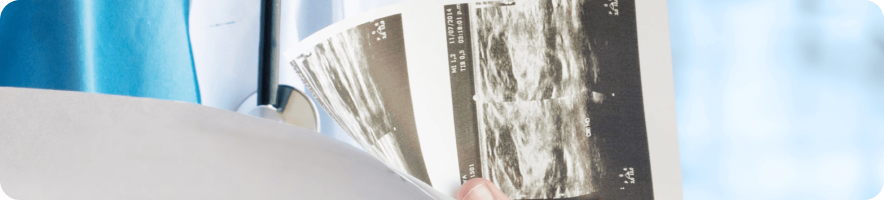 Солидные опухоли с мутацией BRAF V600