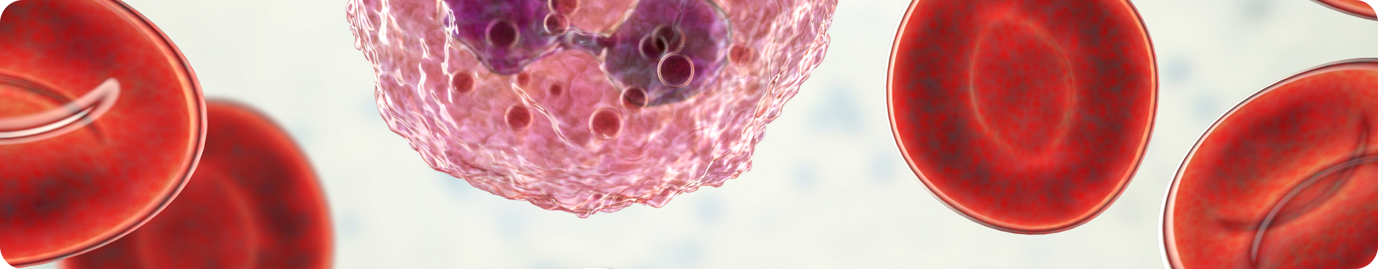 Общая выживаемость пациентов с HR+ HER2− РМЖ, соответствующих критериям включения в исследования NATALEE и monarchE, в реальной клинической практике Общая выживаемость пациентов с HR+ HER2− РМЖ, соответствующих критериям включения в исследования NATALEE и monarchE, в реальной клинической практике