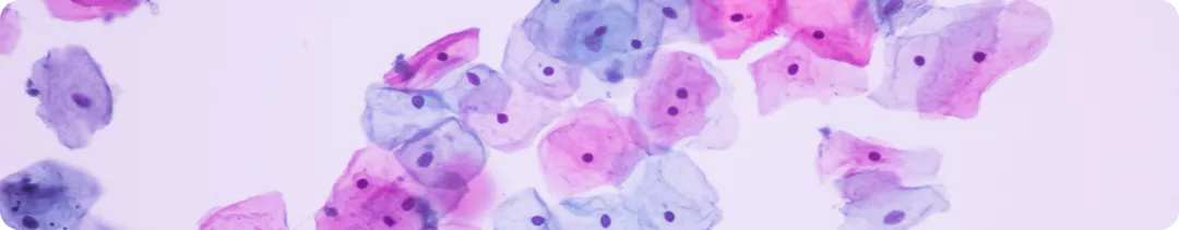 Поддержание качества жизни у больных раком  молочной железы