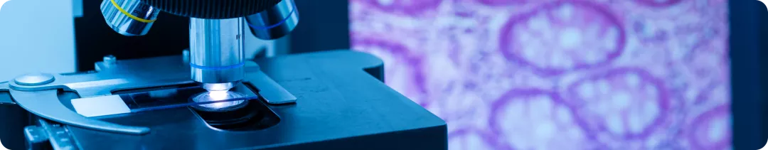 Диагностика первичного миелофиброза