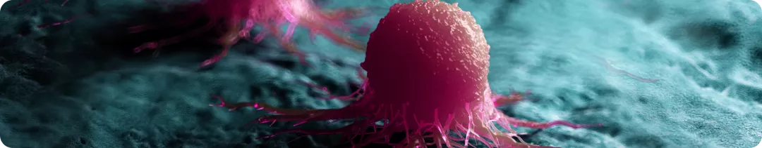 Экономическое и терапевтическое бремя распространенного рака молочной железы: анализ ингибиторов CDK4/6 в рутинной практике