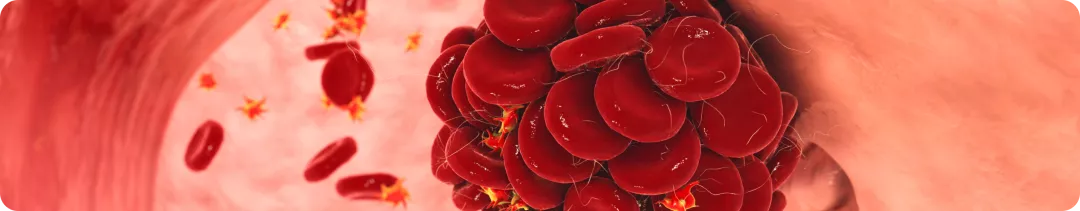 Риск тромбоэмболии при терапии ингибиторами CDK4/6: метаанализ контролируемых исследований