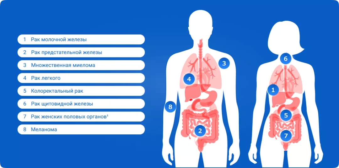 Места метастазирования