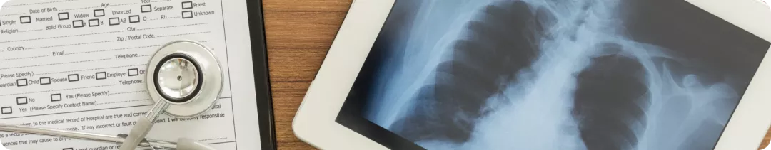 GEOMETRY Mono-1: экспрессия MET и ответ на капматиниб у пациентов с НМРЛ