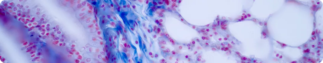 Молекулярно-генетическая диагностика НМРЛ