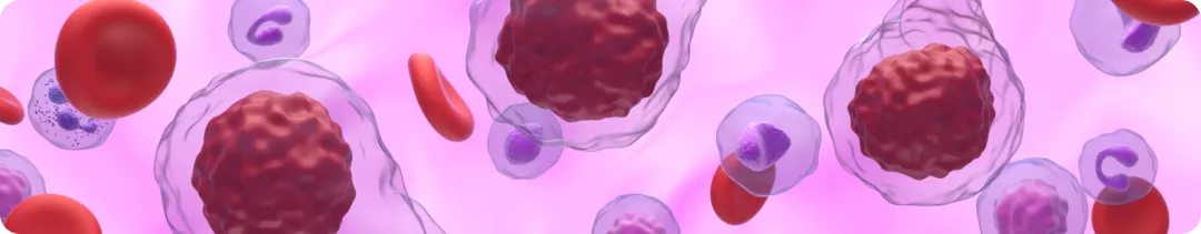 Обновление национальных клинических рекомендаций по диагностике и лечению Ph-негативных миелопролиферативных новообразований