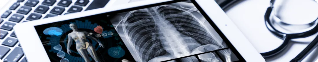 Патоморфологические особенности НМРЛ. Стадирование болезни