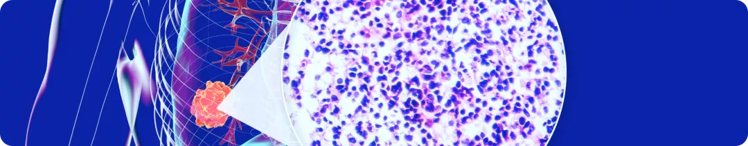 Показатели эффективности терапии церитинибом в исследовании