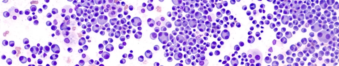 Адъювантная лучевая терапия при РМЖ