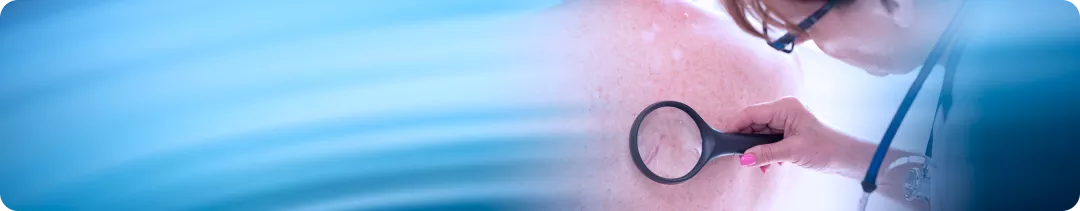 Возврат к таргетной терапии у пациентов с меланомой кожи концепции retreatment и rechallenge