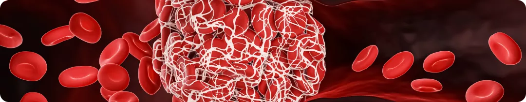 Вторичная профилактика тромбозов