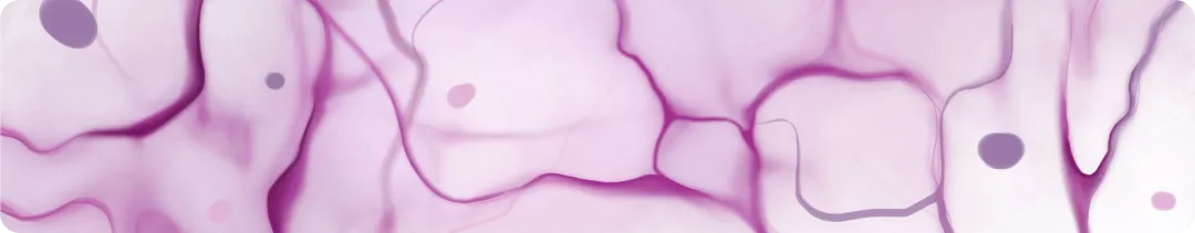 Диабетическая ретинопатия. Общая информация