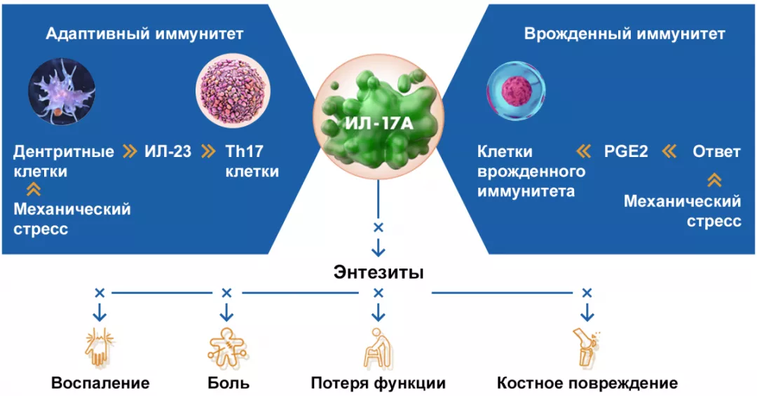 ИЛ-17А — ключевой цитокин развития энтезитов