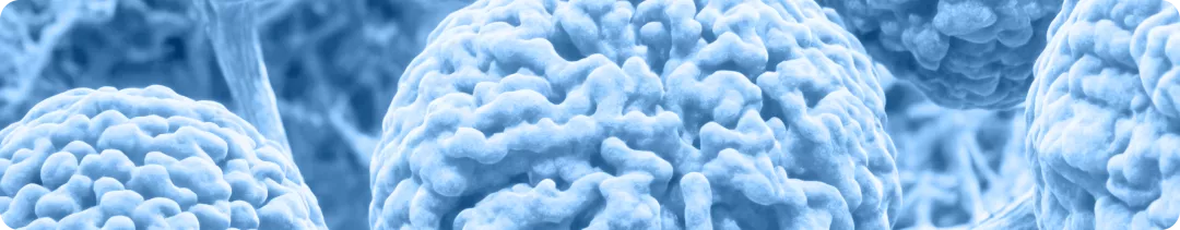 На что стоит обратить внимание у пациента с C3-гломерулопатией?