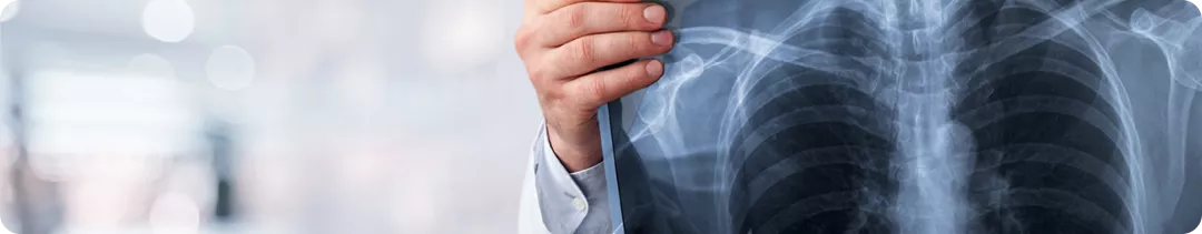 Немелкоклеточный рак легкого