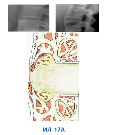Образование новой костной ткани