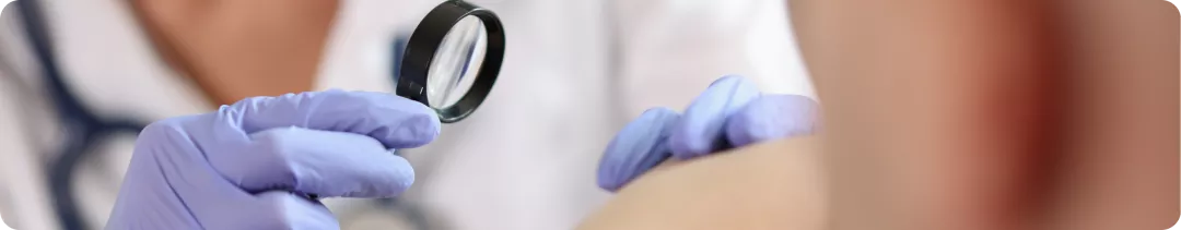 Опросники для определения бремени симптомов