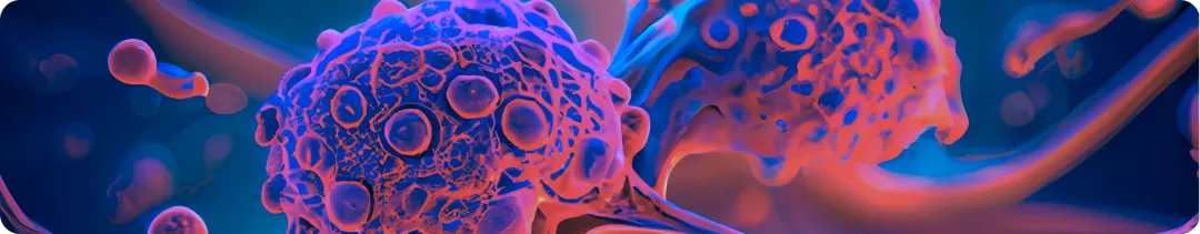 Осложнения истинной полицитемии