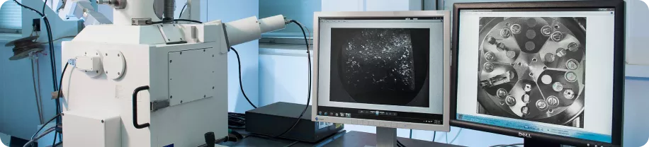 Примерно 25% биопсий требуют применения электронной микроскопии