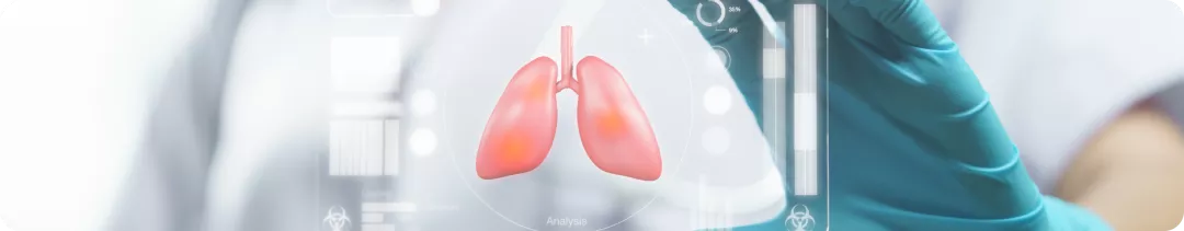 Пять ступеней бронхиальной астмы