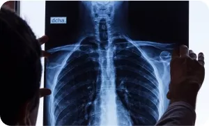 Рентгенография