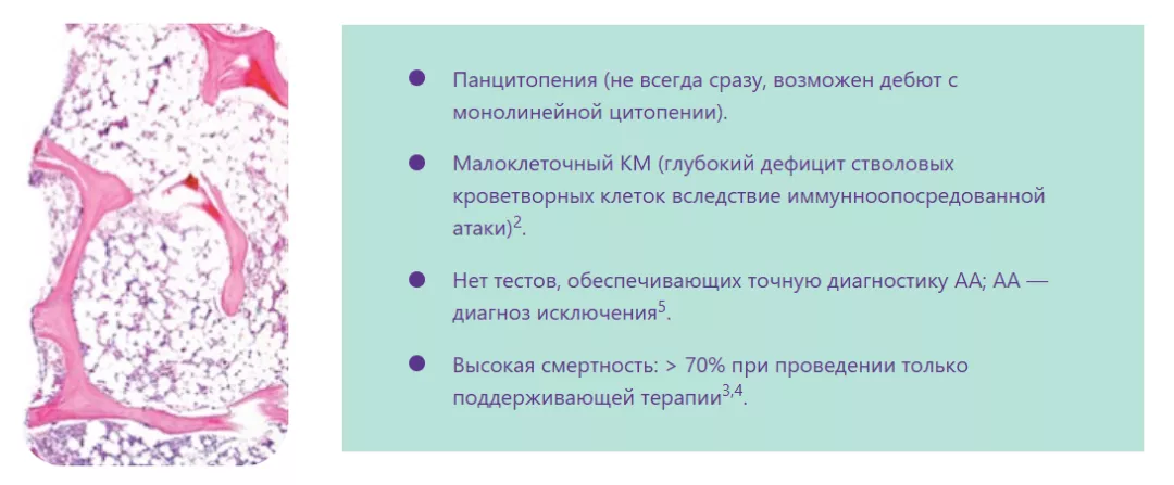 Рисунок из Olnes M.J. et al. N Engl J Med 2012;367:11–19.