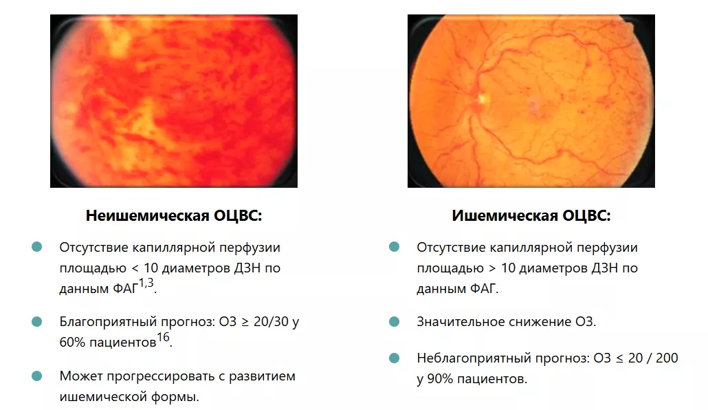 Рисунок 1. Классификация ОЦВС