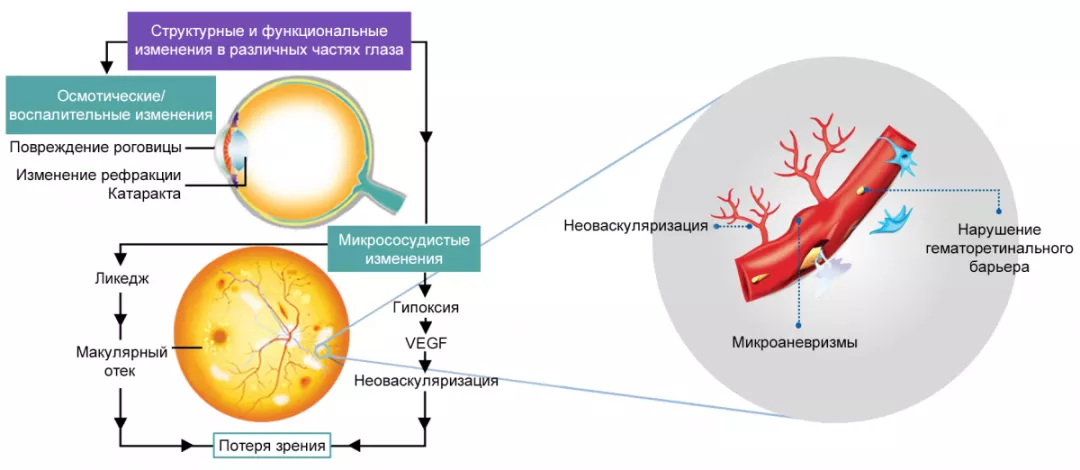 Рисунок 2. Патогенетические механизмы ДР
