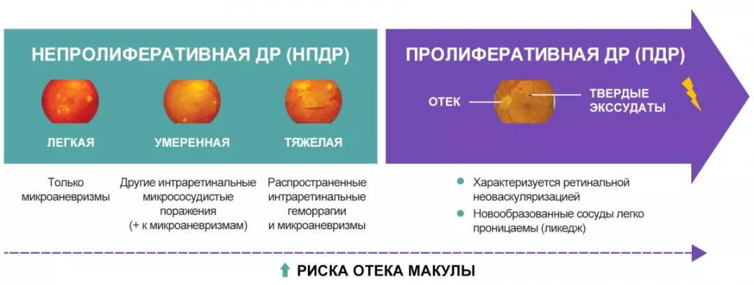 Рисунок 4. Стадии ДР