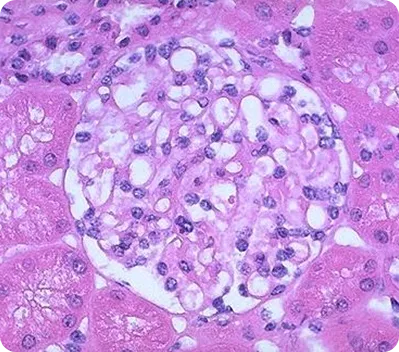 Световая микроскопия в нефрологии