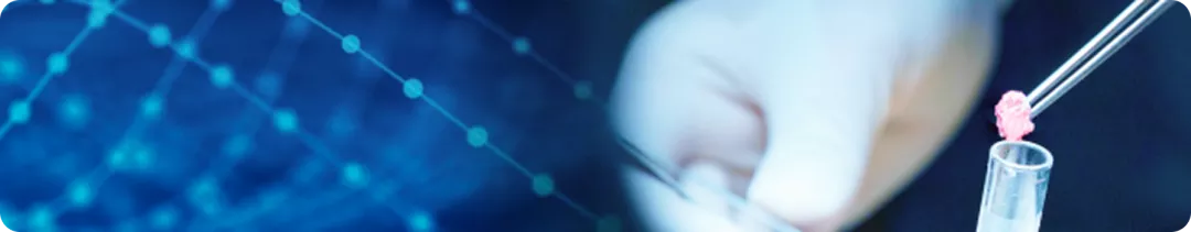 Биопсия сторожевого лимфатического узла при меланоме кожи