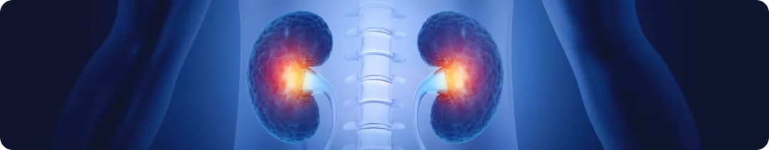 Роль системы комплемента при заболеваниях почек: данные 2024 года (резолюция KDIGO)