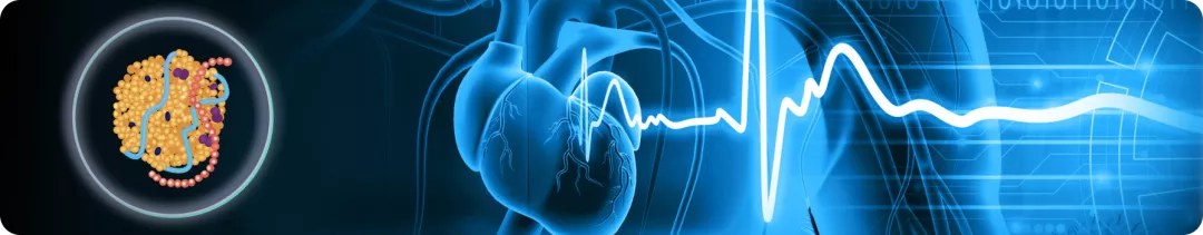 Липопротеин(а) как фактор сердечно-сосудистого риска у пациентов с сахарным диабетом и без него: Регистр Mass General Brigham Lp(a)1