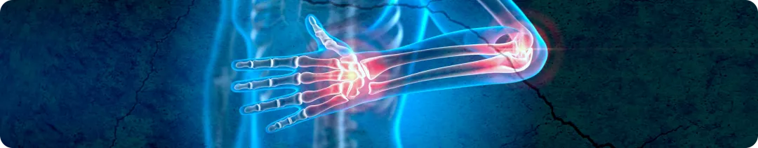 Ревматология