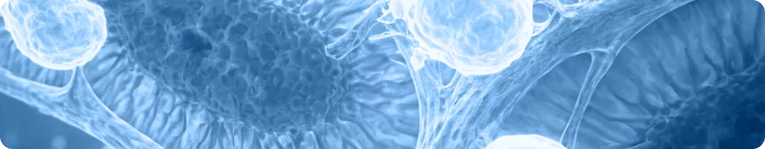 IgA-нефропатия: о чем стоит помнить врачу-нефрологу?