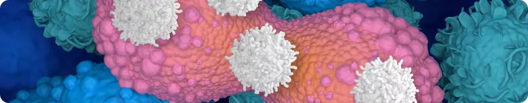 Поражение печени при HR+ HER2- рРМЖ: наблюдение экспертов НМИЦ онкологии им. Н.Н. Блохина