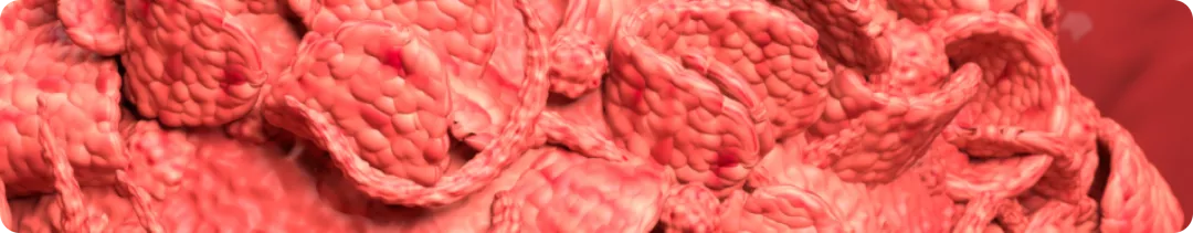 Противоопухолевый эффект и качество жизни: есть ли необходимость жертвовать? Наблюдение экспертов МКНЦ им. А.С. Логинова