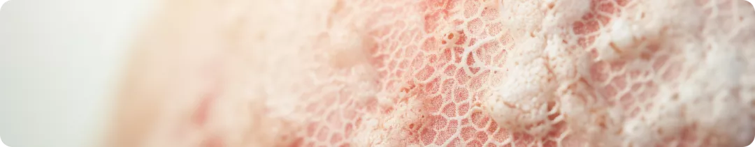 Место рибоциклиба в обновленных алгоритмах лечения 2024