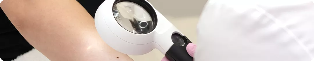 Что, кроме эффективности, важно при выборе адъювантной терапии меланомы кожи?