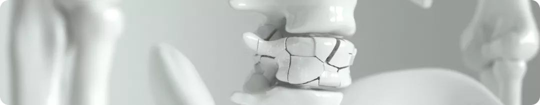 Коротаева Т.В. Основные тенденции диагностики и терапии поражения позвоночника при ПсА в России