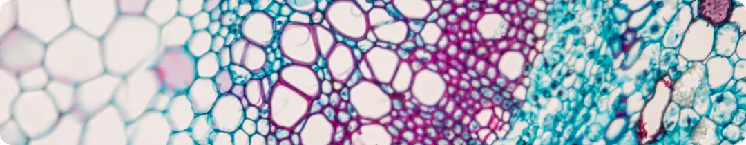 Ретинопатия недоношенных. Общая информация