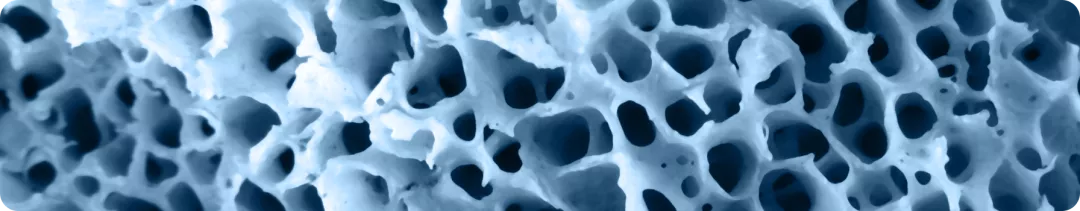 Псориатический и ревматоидный артриты