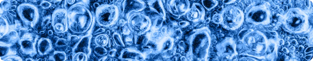 Оценка функциональной активности пациента с аксСпА