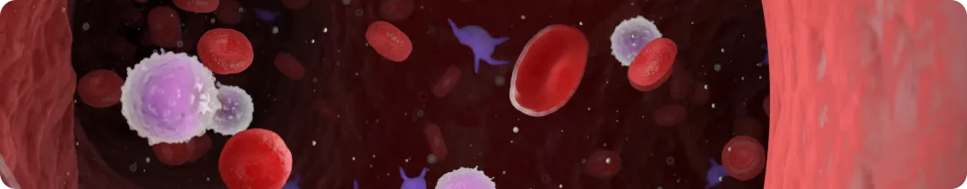 Хориоидальная неоваскуляризация