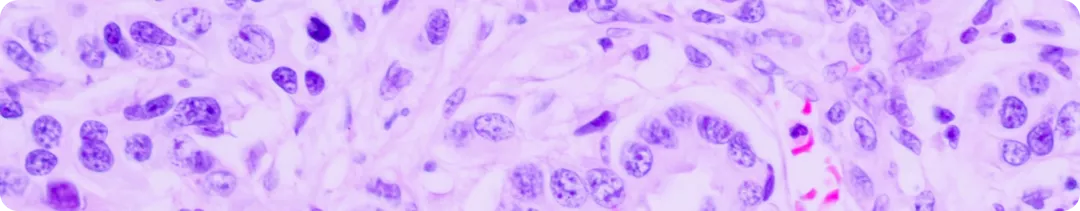 Проблемы лечения рака легкого с активирующими драйверными мутациями