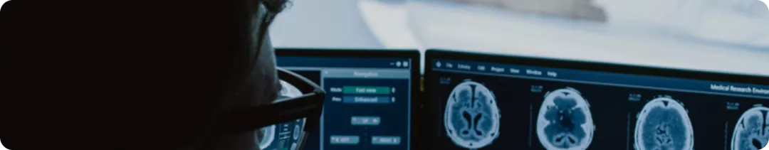 COMBI-MB: Лекарственная терапия пациентов с метастазами меланомы кожи в головной мозг